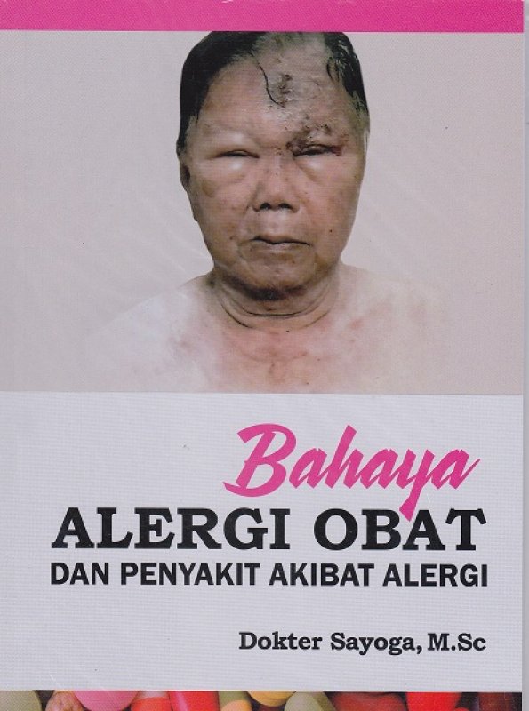 Cover Buku Bahaya Alergi Obat dan Penyakit Akibat Alergi