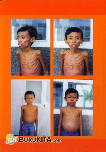 Cover Belakang Buku Atlas Of Paediatrics In The Tropic