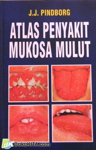 Cover Buku ATLAS PENYAKIT MUKOSA MULUT